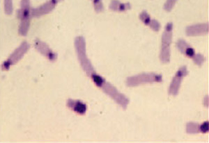 Representative partial metaphase illustrating C banding