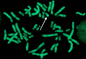 Q-banded metaphase from a healthy male with the Y chromosome