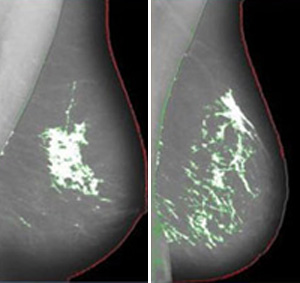 Patterns or variations in breast density.