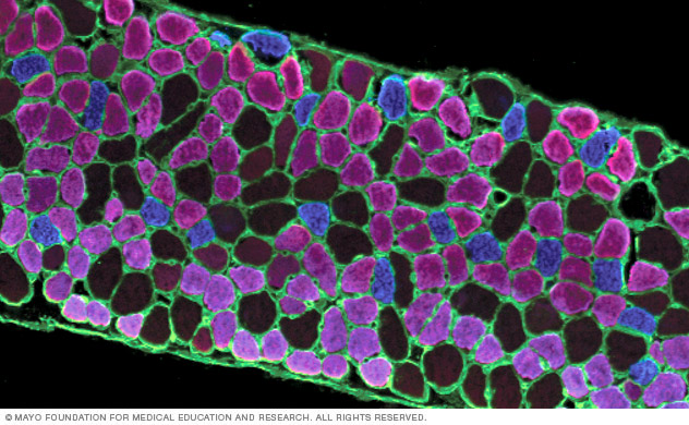 A microscopy image showing diaphragm muscle fibers in cross-section according to fiber type in the Regenerative Physiology Lab of Carlos B. Mantilla, M.D., Ph.D.