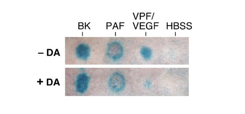 Image showing the effect of dopamine on vascular permeability as induced by bradykinin (BK), platelet-activating factor (PAF) and vascular permeability factor/vascular endothelial growth factor (VPF/VEGF)