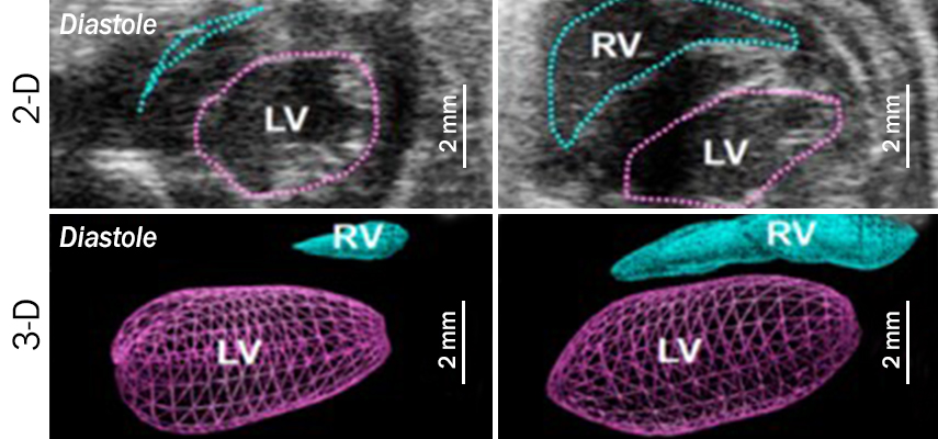 Image showing echocardiography of wild-type mice (left) and smooth muscle protein 22α-NRP1 knockout mice (right)