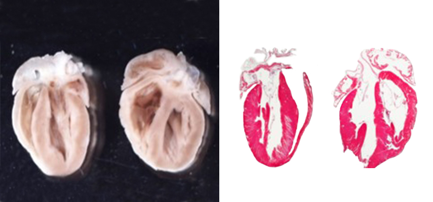 Image showing the heart morphology of wild-type mice (left) and smooth muscle protein 22-NRP1 knockout mice (right). The knockout mice are deficient in NRP1 in cardiomyoctyes and smooth muscle cells and show enlarged right ventricles.