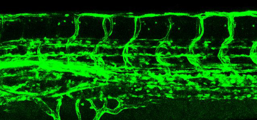 Confocal image of intersegmental vessels of a 3-day-old zebrafish embryo