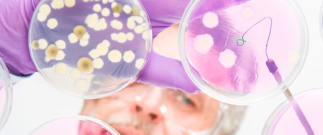 Purple-gloved researcher wearing lab goggles is inspecting contents of petri dishes.