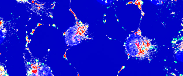 Microscopy of live neurons stained with lysotracker and mitotracker showing areas with highest intensities in red and nuclei in blue