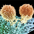 Cancer Immunotherapy: Impress Study