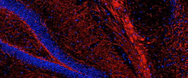 Microscopy of myelin sheath in hippocampus