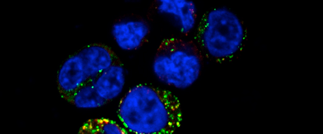 NCI-H716 cells, an in vitro model of human enteroendocrine cells, enable research on satiety hormones GLP-1 (green) and PYY (Red) as shown in this immunofluorescence confocal microscopy image from the Precision Medicine for Obesity Lab.