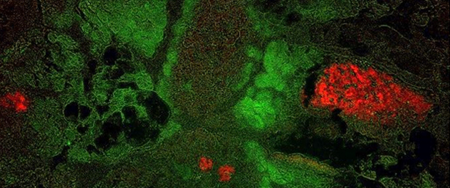 The uptake of near-infrared 2-deoxyglucose (NIR 2-DG), in green, occurs in areas that undergo necrosis, which mostly lack nuclear detail from the Pancreatitis and Acute Outcomes Lab, led by Vijay P. Singh, M.B.B.S., at Mayo Clinic.