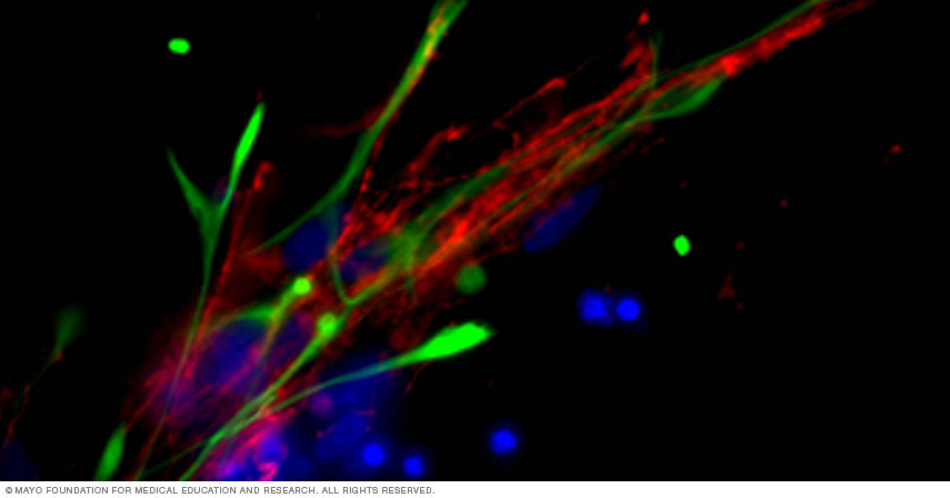 Neural progenitor cells shown in organotypic cell migration model