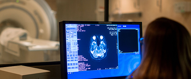 Person looking at a computer monitor showing an MRI brain scan