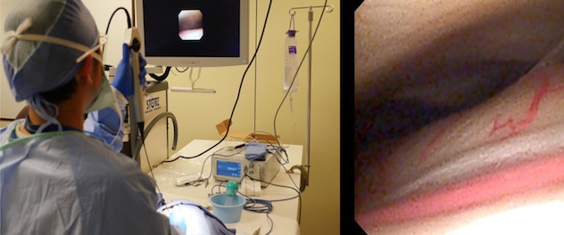 Manipulation through endoscope with 360-degree rotation illustrated.