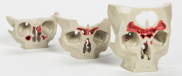 3D models of sinuses