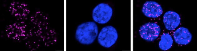 Three-panels showing proximity ligation assay (PLA) signaling in human regulatory T (Treg) cell microscopy