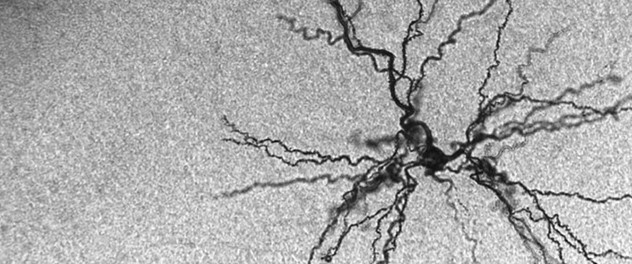 Neocortical neuron