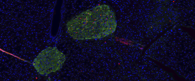 Microscopy showing stained pancreatic islets.