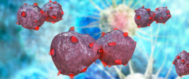 An illustration showing microscopic lung cancer cells