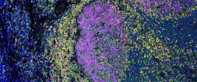 High-plex normal human tonsil tissue stained to detect immune cells and structural proteins