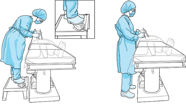 Drawing compares improper versus proper operating room ergonomic postures.