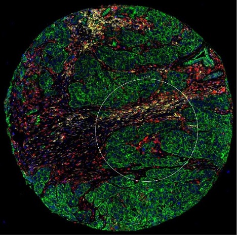 Micron region of interest