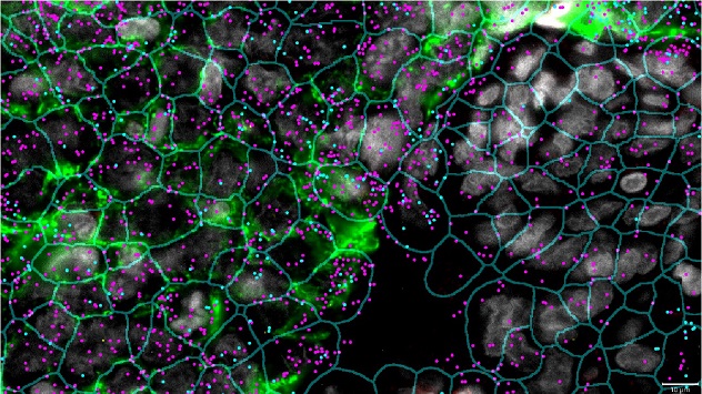 With the CosMx Spatial Molecular Imaging platform, two major histocompatibility complex (MHC) transcripts are overlaid on the cell segmentation pattern.