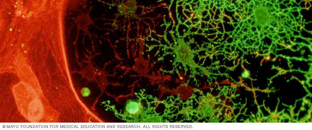 Microscopy of glial cells showing astrocytes in red and oligodendrocytes in green