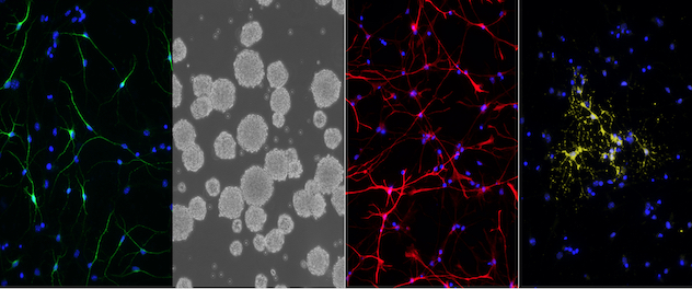 Four microscopy panels differentiate neural stem cells.