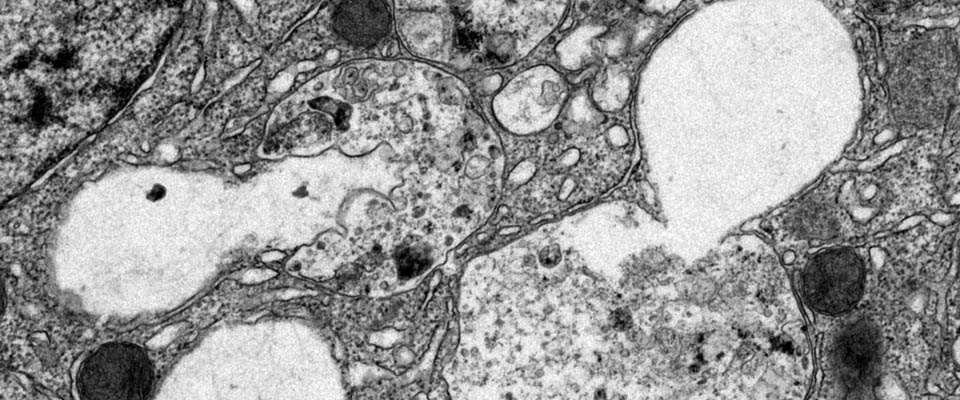 Transmission electron micrograph showing fat being catabolized by lysosomes through the process of autophagy after a period of nutrient restriction