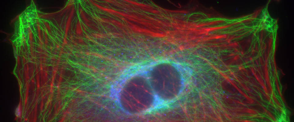 Fluorescence micrograph showing the actin cytoskeleton, microtubule cytoskeleton and the Golgi apparatus in a healthy cell