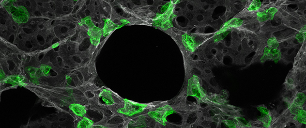 Alveolar structure