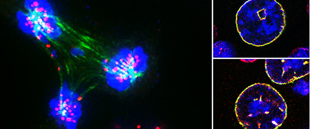 Immunofluorescence microscopy images of prostate cancer cells