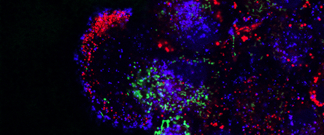  Migrating cells use acidic, degradative organelles called lysosomes to regulate lipid metabolism