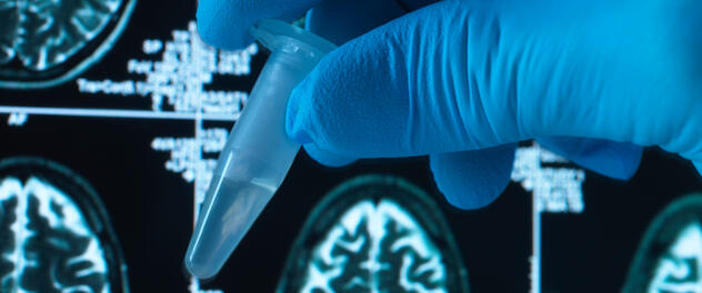 A hand in a latex glove holding a laboratory test tub in front of a computer screen with brain imaging