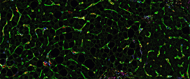 Myeloid cells-liver sinusoidal endothelial cells adhesion in MASH