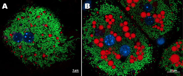 Mitochondrial-lipid droplets interaction in lipotoxic hepatocyte